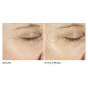 dr-dennis-gross-triple-correction-eye-serum-15ml-before-after