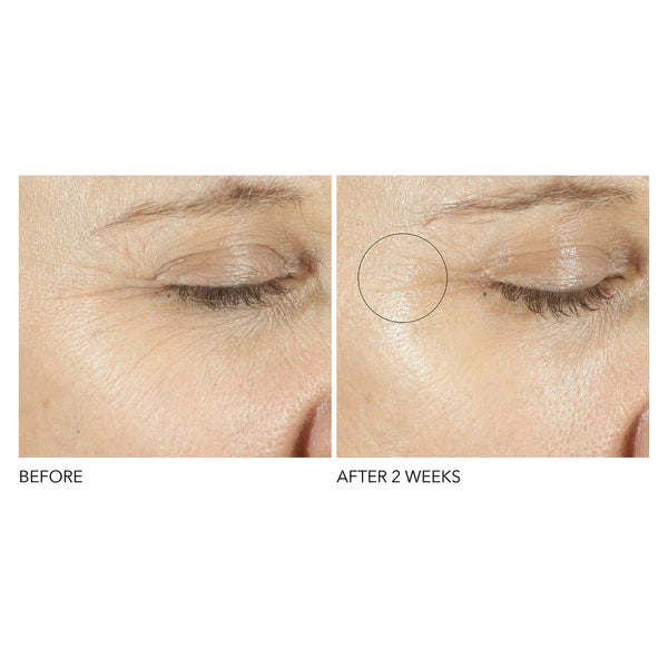 dr-dennis-gross-triple-correction-eye-serum-15ml-before-after