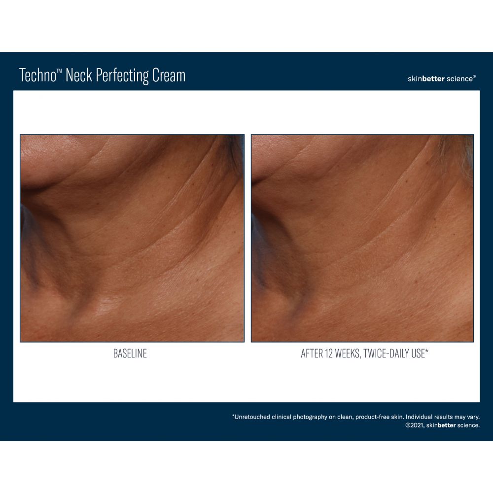 Techno Neck Perfecting Cream 50ml