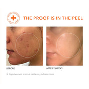 Alpha Beta® Extra Strength Daily Peel 30stk