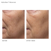 Alpha Beta® Daily Moisturizer 50ml Before and After
