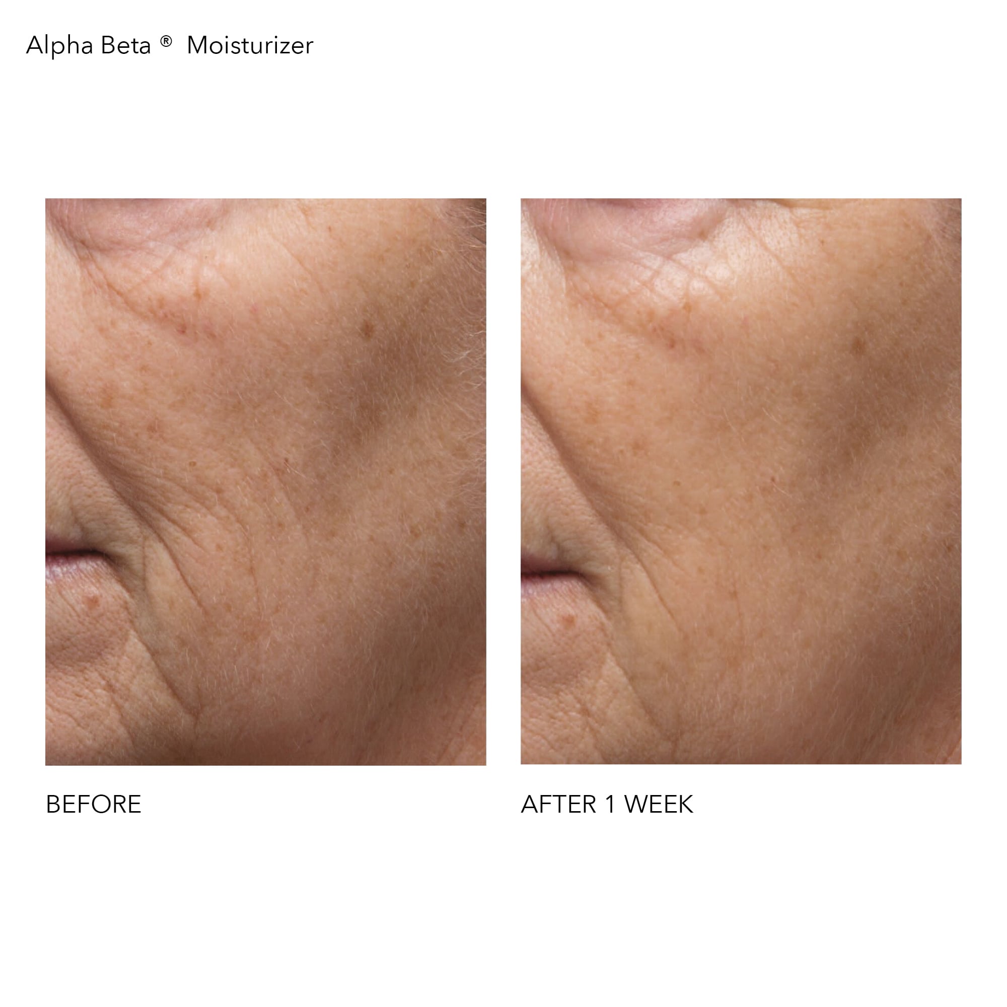 Alpha Beta® Daily Moisturizer 50ml Before and After