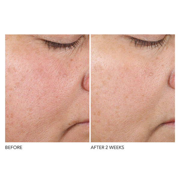 dr-dennis-gross-texture-renewal-serum-30ml-before-after