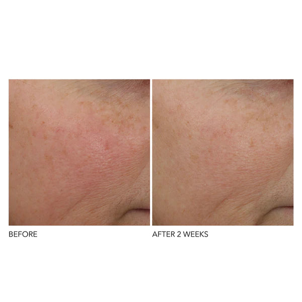 dr-dennis-gross-overnight-wrinkle-treatment-30ml-before-after